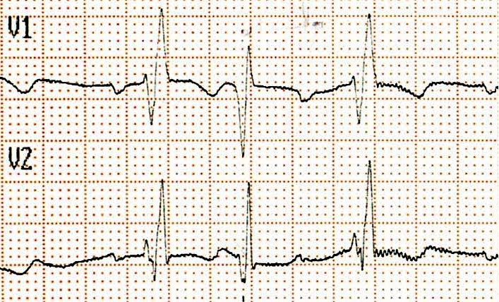 XVI_8index