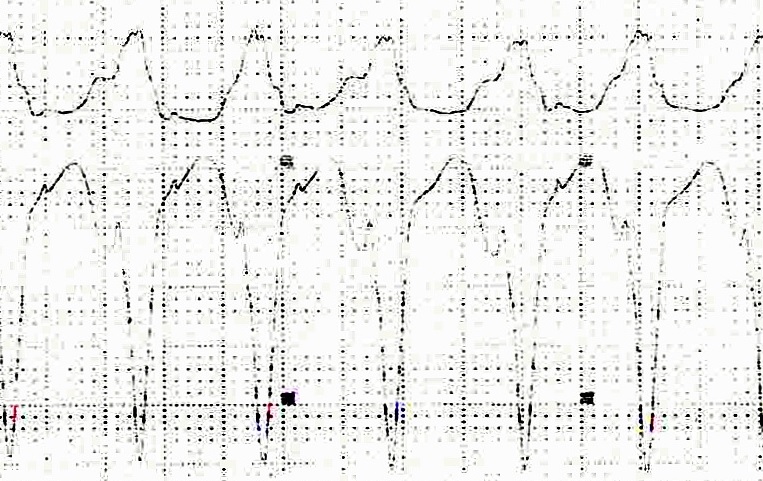 XVI_18index