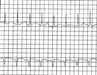 XVI_2index